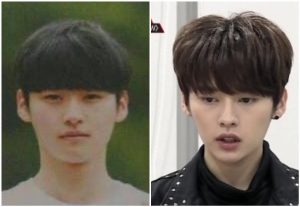 リノオーディション前後比較