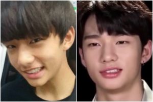 ヒョンジン-オーディション前後比較